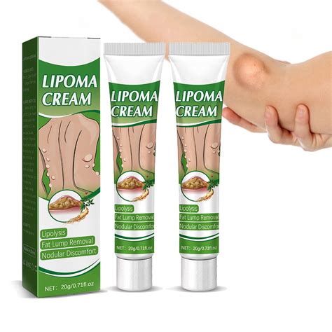 00 - RM72. . Cream for lipoma